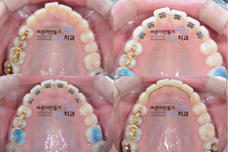 ae79cfc2b140c0e7fd1ee5d0136a9a4d_1434609