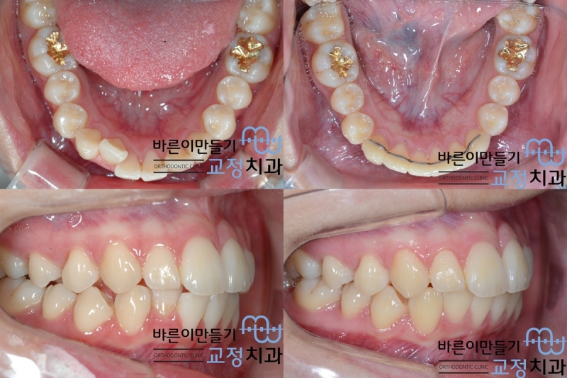 a64b063a907ff9a3118f7fbac2ae8730_1438331