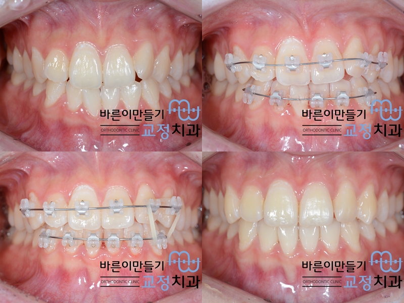 da40ccc30f1654485c7a67f123daaf59_1443683808_631.jpg da40ccc30f1654485c7a67f123daaf59_1443683