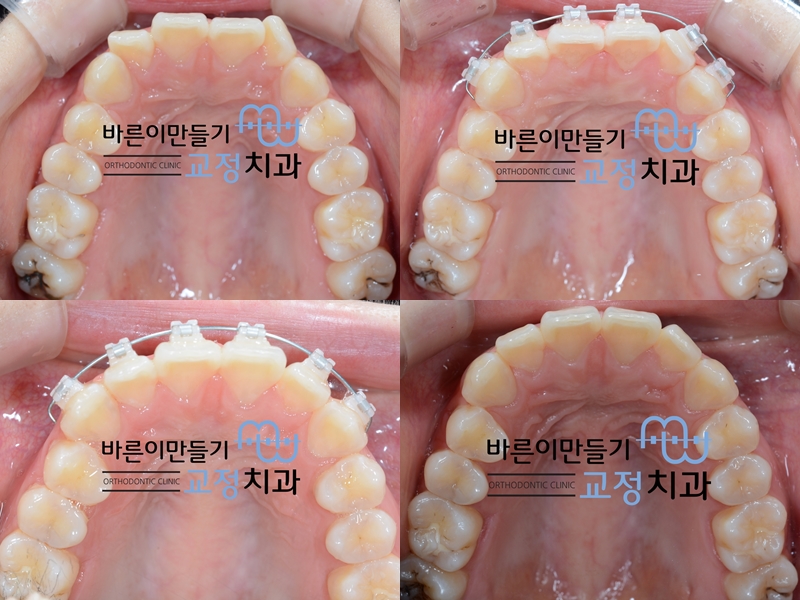 da40ccc30f1654485c7a67f123daaf59_1443683822_4234.jpg da40ccc30f1654485c7a67f123daaf59_1443683