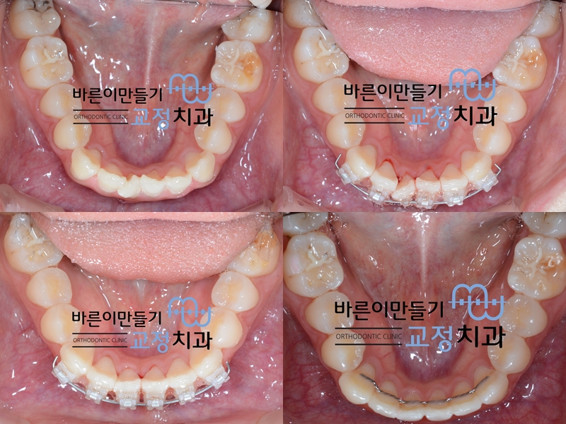 da40ccc30f1654485c7a67f123daaf59_1443683824_181.jpg da40ccc30f1654485c7a67f123daaf59_1443683