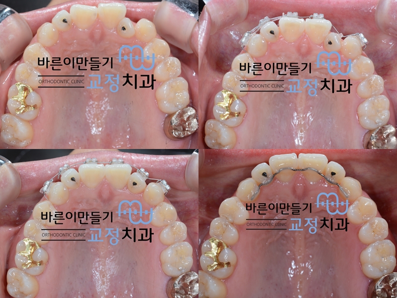 787ce92bd2af07541ed8a9572ef57153_1453445