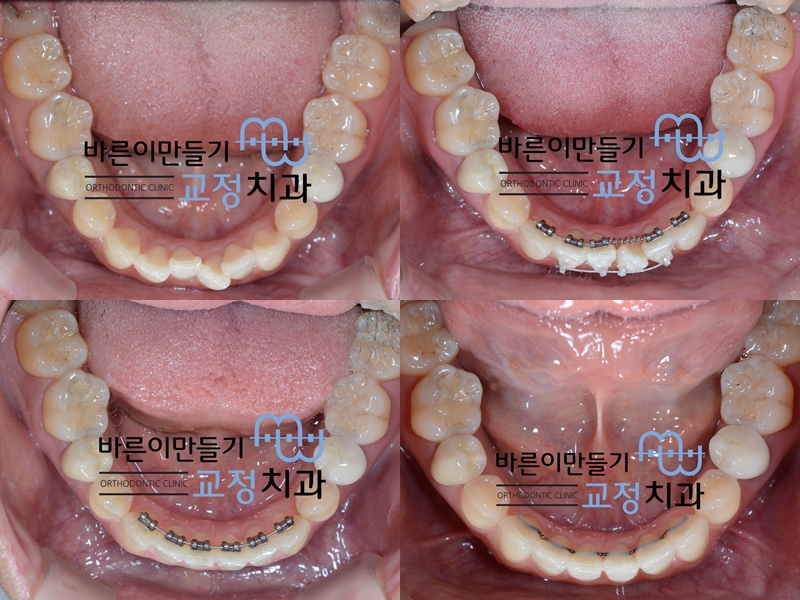 787ce92bd2af07541ed8a9572ef57153_1453445