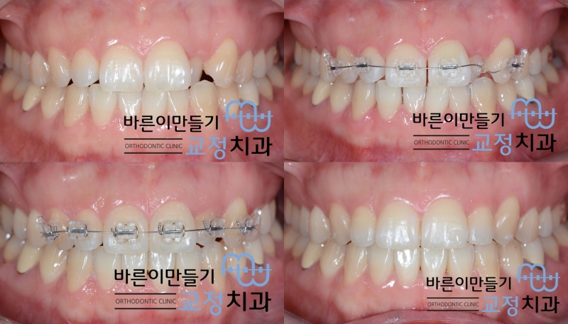 787ce92bd2af07541ed8a9572ef57153_1453445