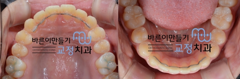 0d3edce5449ef3fe75d4ae13b4127d0a_1457080